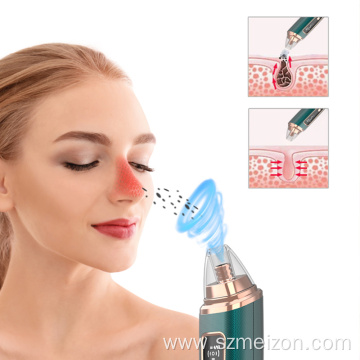 Electric Acne Pore Cleaner Blackhead Remover Vacuum